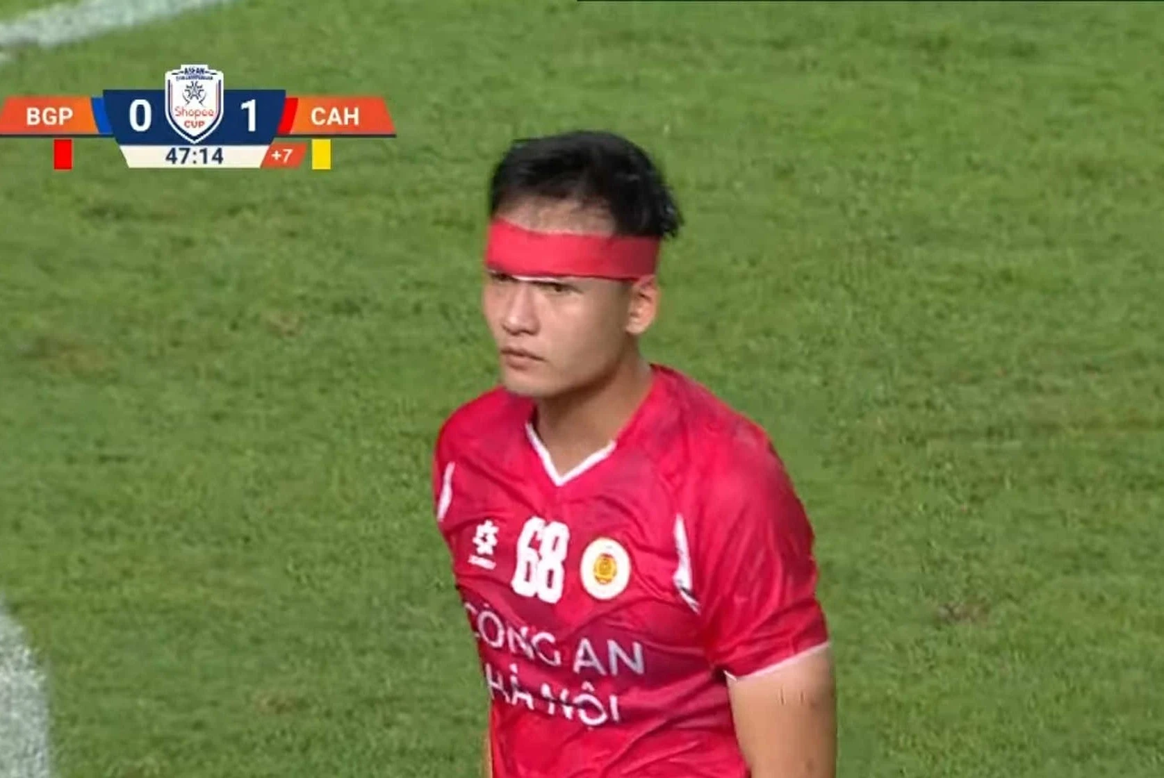 Bùi Hoàng Việt Anh nhập viện ngay trận mở màn Cúp C1 Đông Nam Á