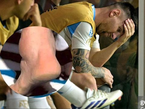 Messi bật khóc nức nở rời sân sớm, Aghentina vẫn vô địch thuyết phục